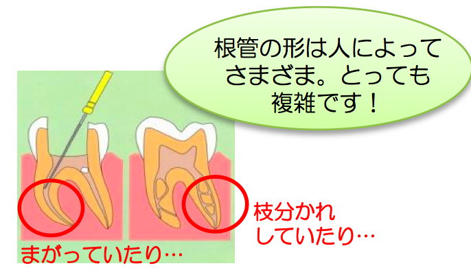 根の形